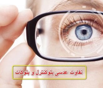 بررسی تفاوت عدسی بلوکنترل و بلوکات
