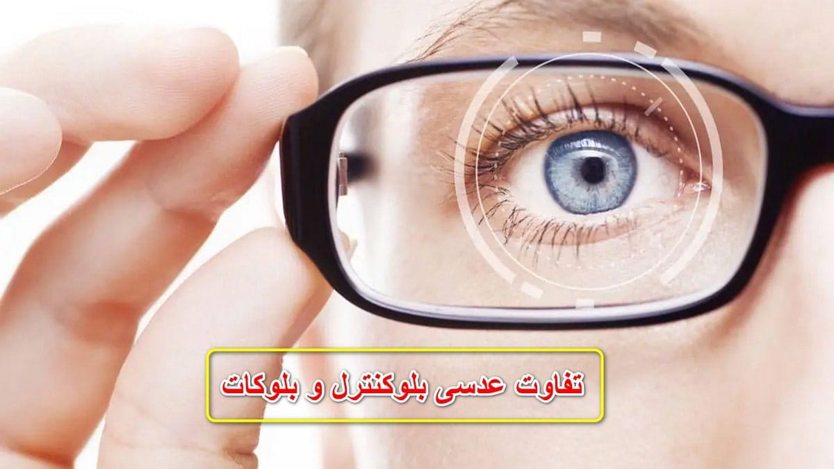 تفاوت عدسی بلوکنترل و بلوکات